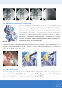 Spine_e_XIV-07